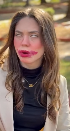 T0401015 Amiga ficou cega! part2